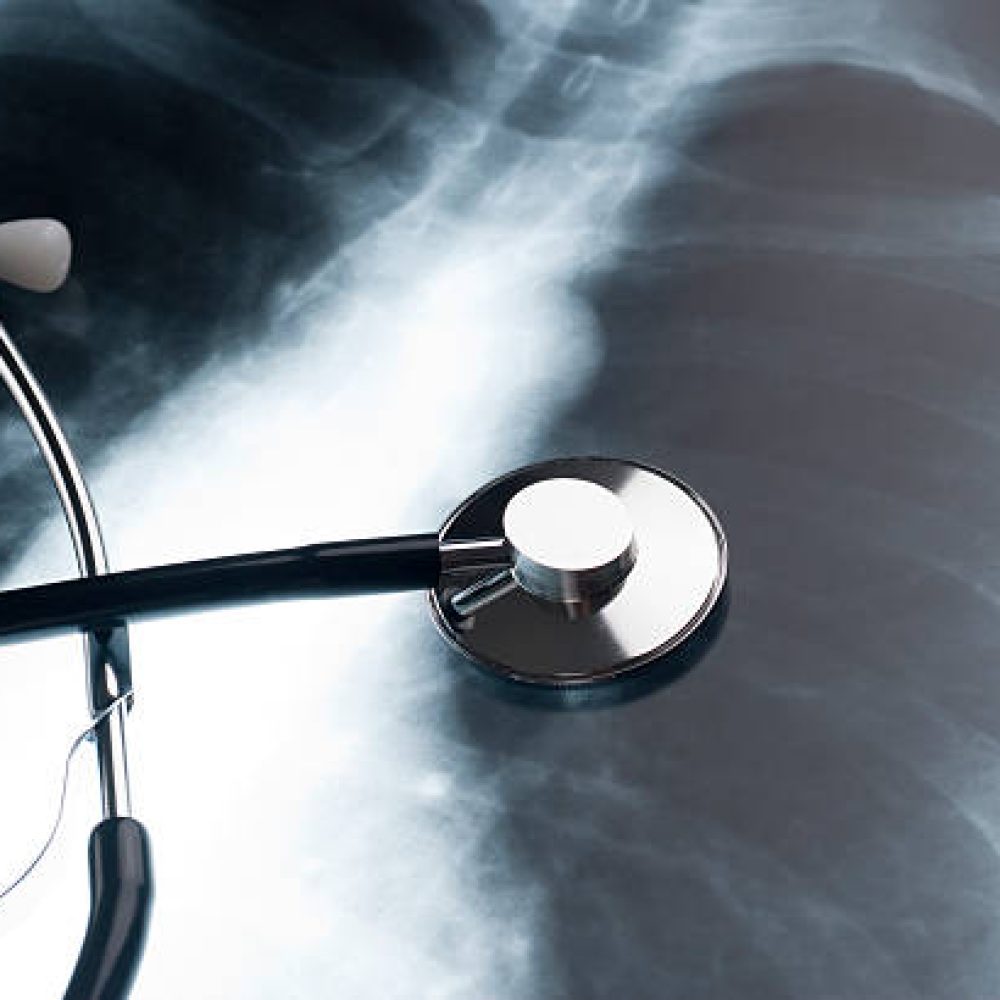 Physician stethoscope on an XRAY of a human chest